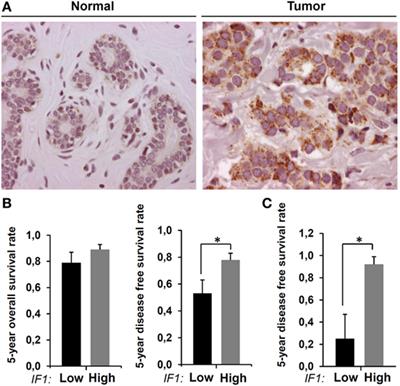 Overexpression of the ATPase Inhibitory Factor 1 Favors a Non-metastatic Phenotype in Breast Cancer